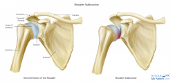 Shoulder articles | Rehab My Patient