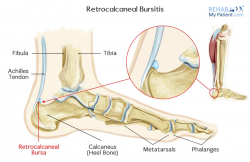 Articles | Rehab My Patient