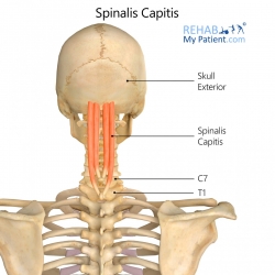 Neck articles | Rehab My Patient