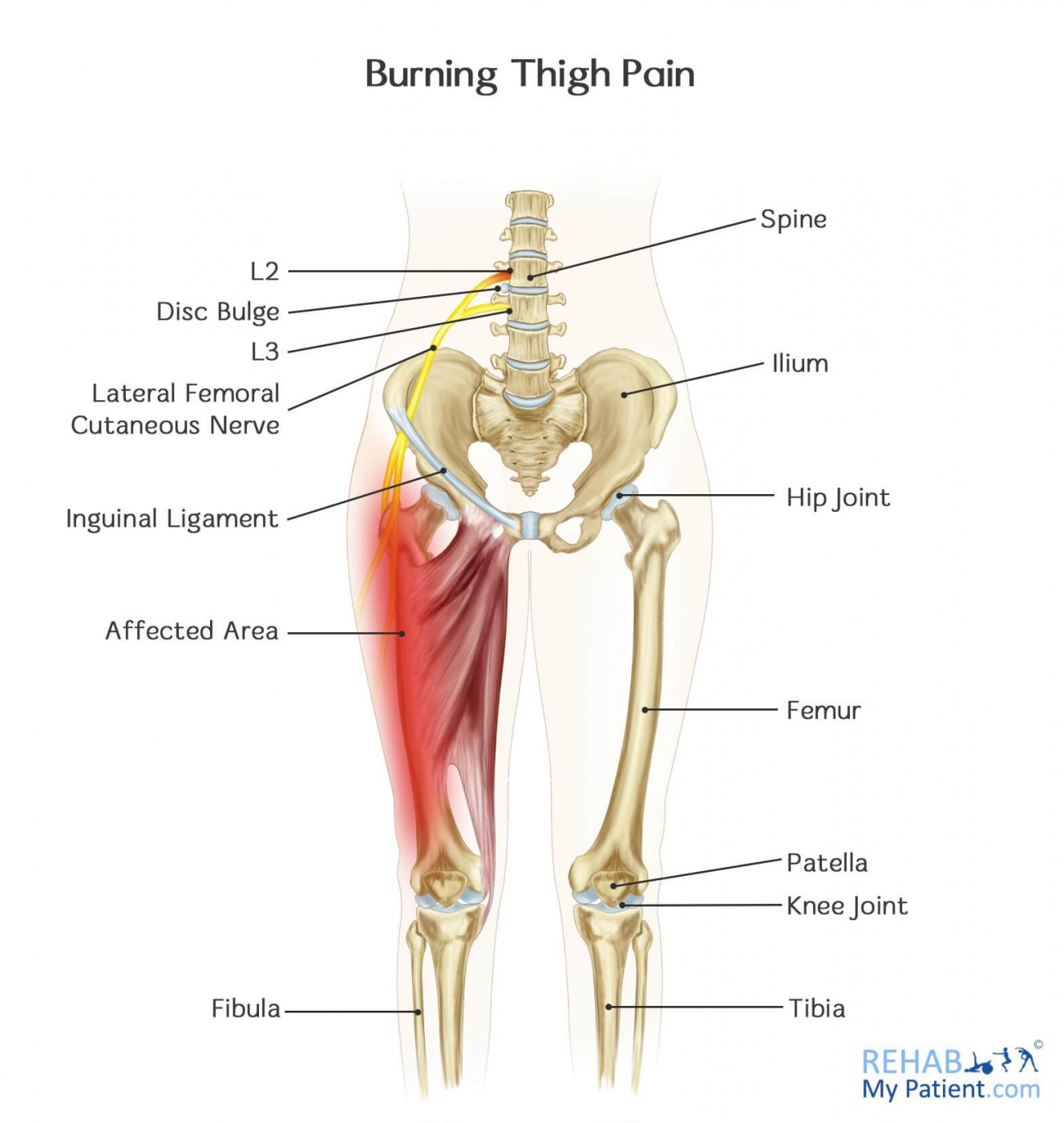 side of knee pain burning
