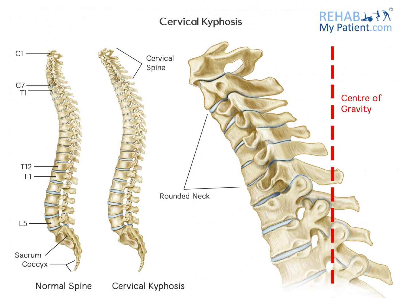 Know Your Neck: The Cervical Spine