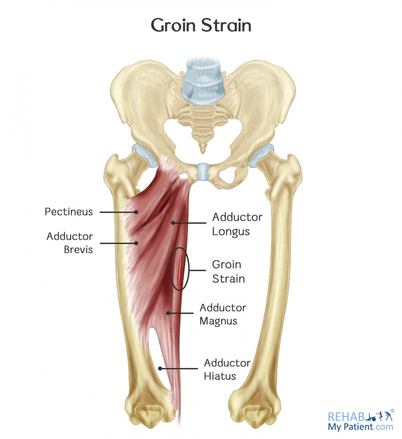 PRO MMR Sport Recovery - GROIN PAIN ‼️‼️‼️ Groin is an area of your hip  that is between the stomach and thigh. It is made up of five different  muscles that are