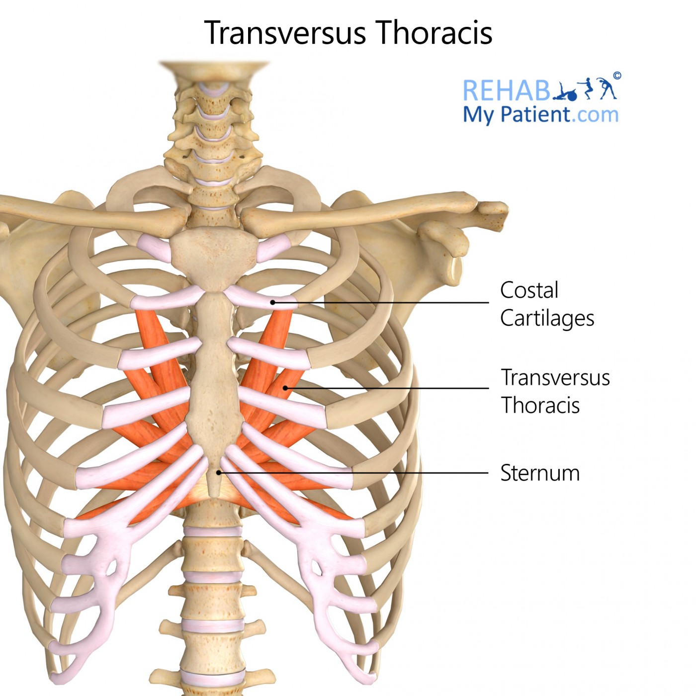 Transversus Thoracis